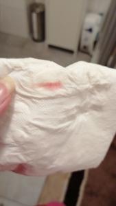 Auf toilettenpapier blut Hämorrhoiden Blut
