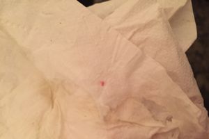 Toilettenpapier einnistungsblutung Hellbraune schmierblutung