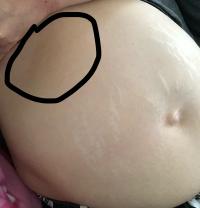 Schwangerschaft stiche rechter oberbauch Bauchschmerzen in